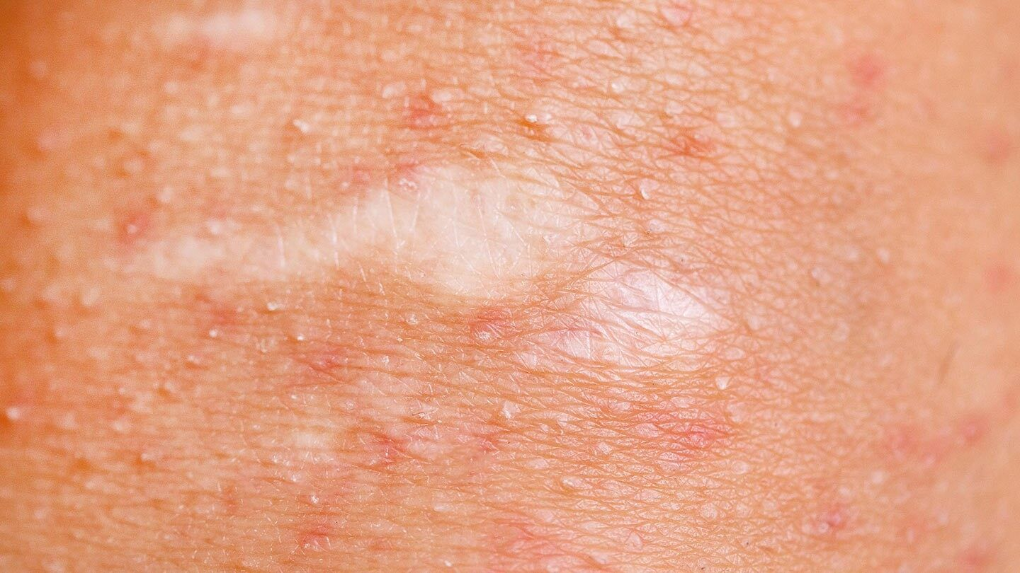 Common Skin Conditions And How To Treat Them Creative Punking