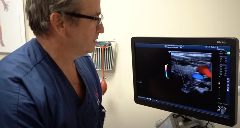 How Vascular Surgeons Help Prevent Stroke